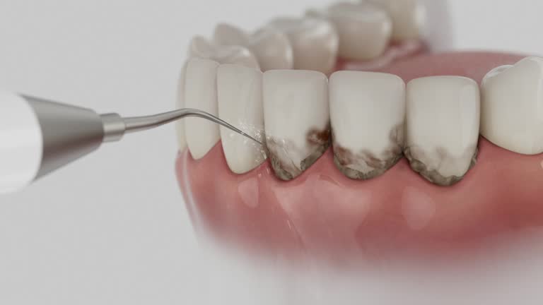 Trusted Wisdom Tooth Removal service in Pawhuska, OK - Dentist Open Now